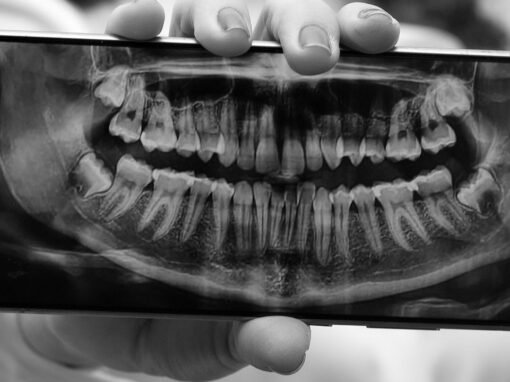 Perodontograma o Periodontograma, ¿Qué es y para que sirve? Perodontograma o Periodontograma, ¿Qué es y para que sirve?