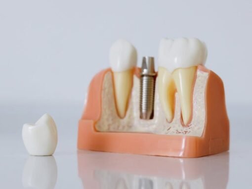 IA en el Diagnóstico Dental: ¿Solo una Moda? IA en el Diagnóstico Dental: ¿Solo una Moda?