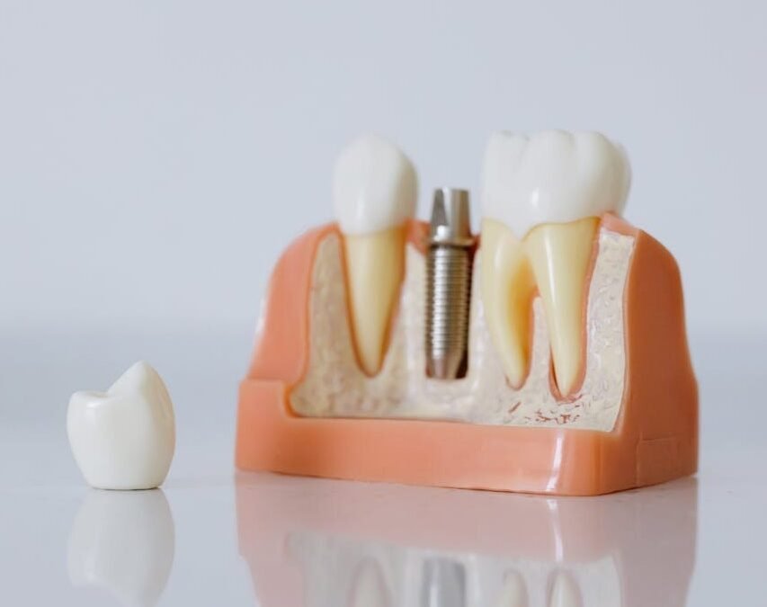 IA en el Diagnóstico Dental: ¿Solo una Moda?