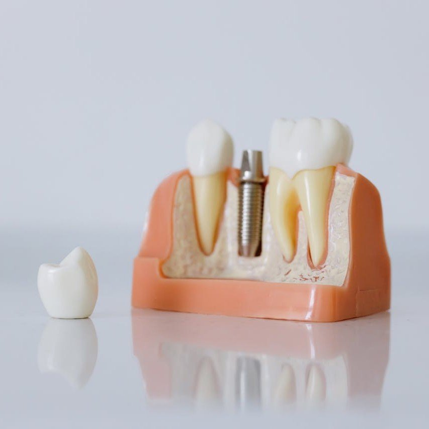 IA en el Diagnóstico Dental: ¿Solo una Moda?